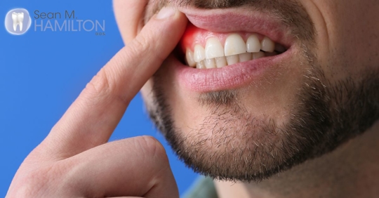 man showing off his teeth and gums